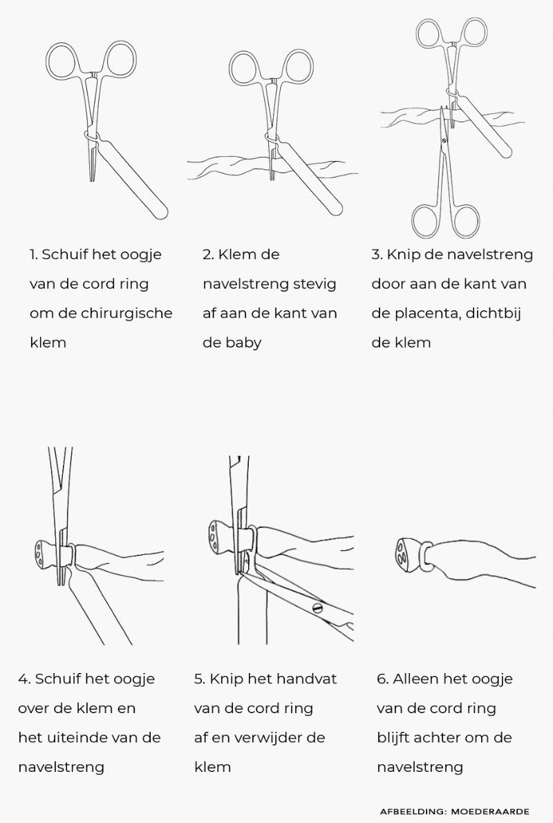 De handleiding voor het gebruik van de cetro cordring