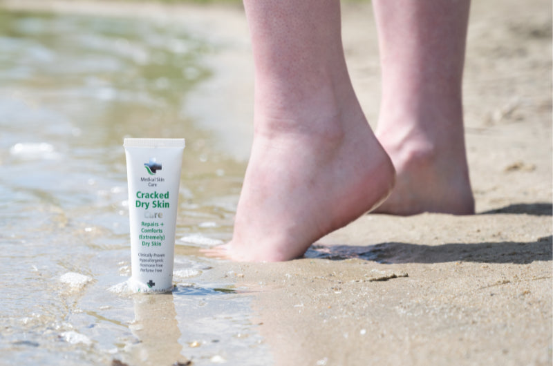 Alhydran Cracked Dry Skin Care